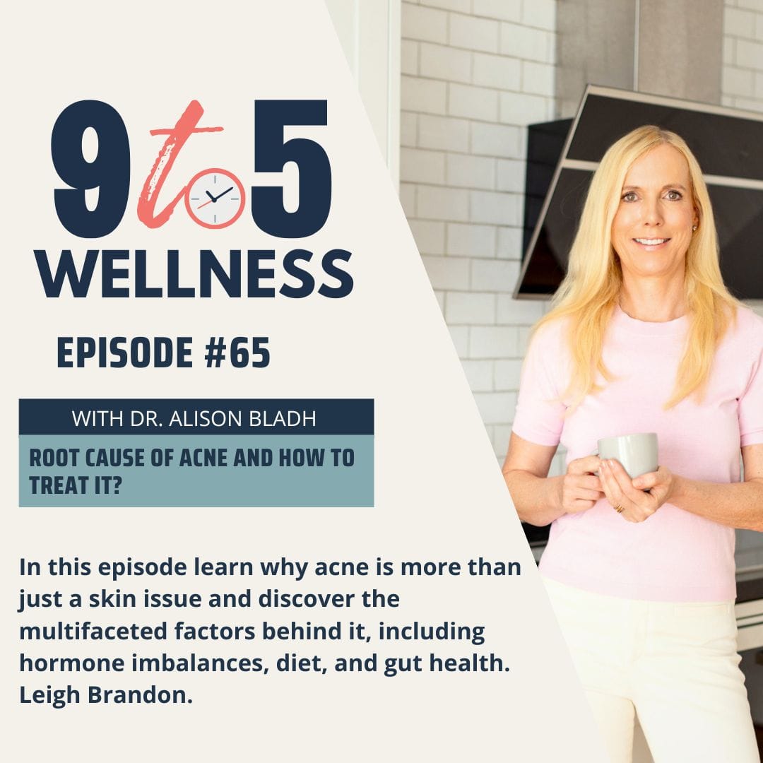 Root Cause of Acne and How to Treat it